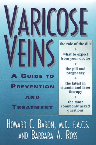 Book cover for Varicose Veins