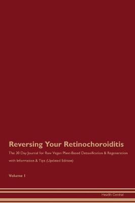 Book cover for Reversing Your Retinochoroiditis