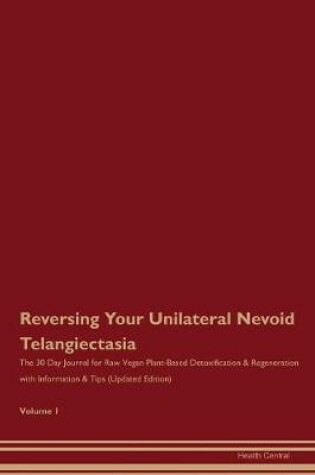 Cover of Reversing Your Unilateral Nevoid Telangiectasia