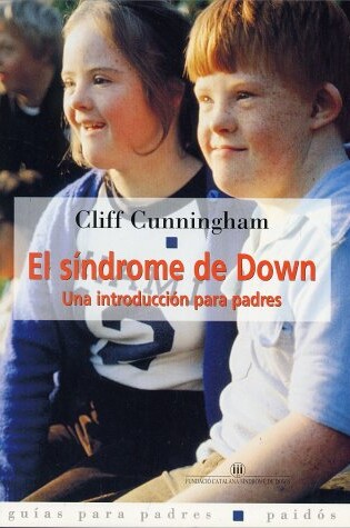 Cover of El Sindrome de Down