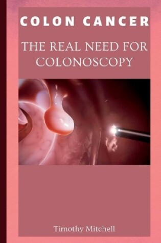 Cover of Colon Cancer