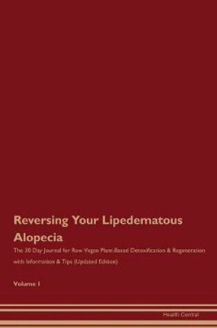 Cover of Reversing Your Lipedematous Alopecia