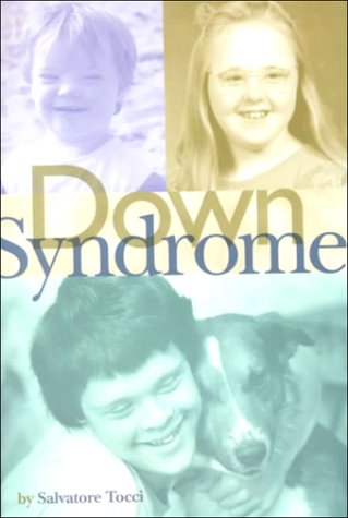 Cover of Down Syndrome