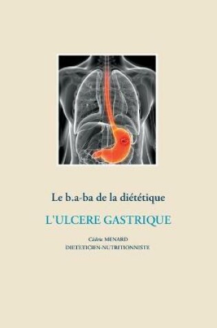 Cover of Le b.a-ba de la diététique pour l'ulcère gastrique