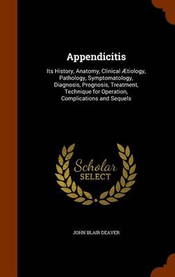Book cover for Appendicitis