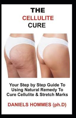 Book cover for The Cellulite Cure