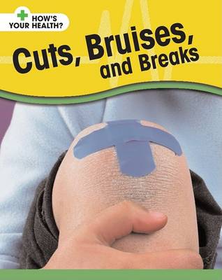 Book cover for Cuts, Bruises, and Breaks