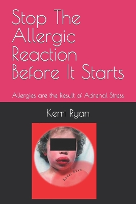 Book cover for Stop The Allergic Reaction Before It Starts