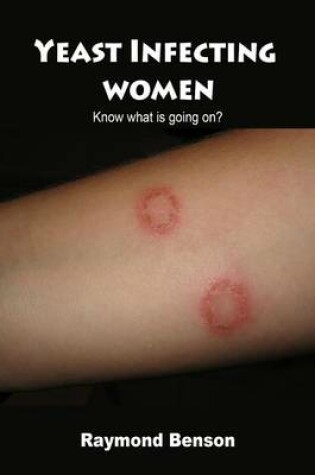 Cover of Yeast Infecting Women