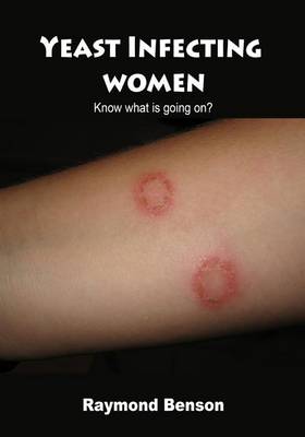 Book cover for Yeast Infecting Women