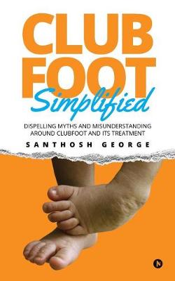 Book cover for Clubfoot Simplified