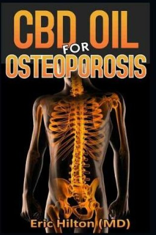 Cover of CBD Oil for Osteoporosis