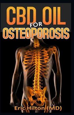 Book cover for CBD Oil for Osteoporosis