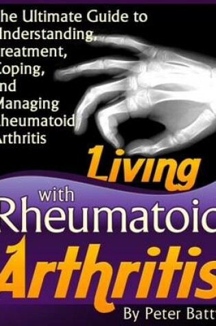 Cover of Living With Rheumatoid Arthritis - The Ultimate Guide to Understanding, Treatment, Coping, and Managing Rheumatoid Arthritis