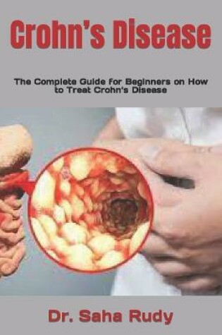 Cover of Crohn's Disease