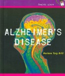 Cover of Alzheimer's Disease