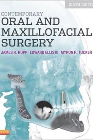Cover of Contemporary Oral and Maxillofacial Surgery - E-Book