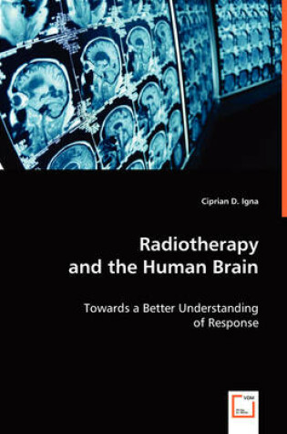 Cover of Radiotherapy and the Human Brain