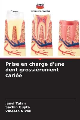 Book cover for Prise en charge d'une dent grossi�rement cari�e