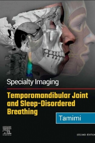 Cover of Temporomandibular Joint and Sleep-Disordered Breathing E-Book
