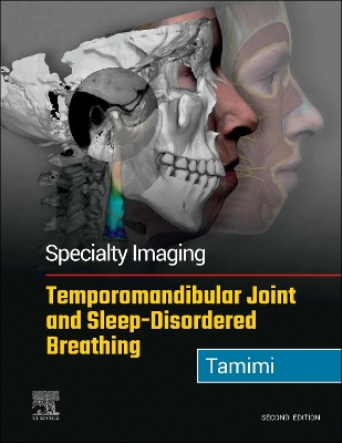 Cover of Temporomandibular Joint and Sleep-Disordered Breathing E-Book