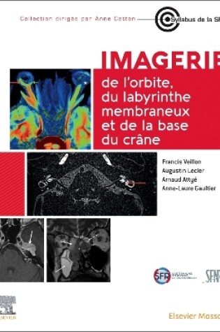 Cover of Imagerie de l'Orbite, Du Labyrinthe Membraneux Et de la Base Du Crâne