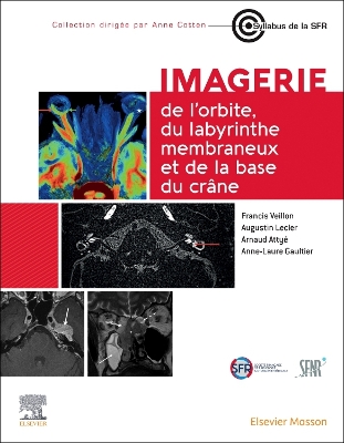 Cover of Imagerie de l'Orbite, Du Labyrinthe Membraneux Et de la Base Du Crâne