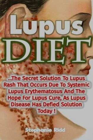 Cover of Lupus Diet: The Secret Solution to Lupus Rash That Occurs Due to Systemic Lupus Erythematosus and the Hope for Lupus Cure, As Lupus Disease Has Defied Solution Today!