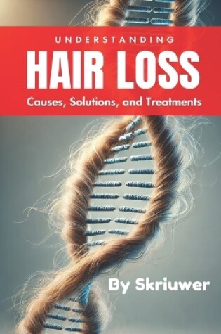 Cover of Understanding Hair Loss in Men