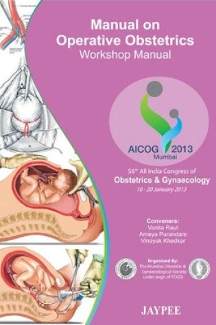 Cover of Manual on Operative Obstetrics: Workshop Manual