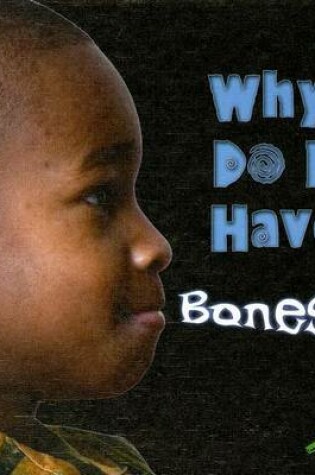 Cover of Why Do I Have Bones?