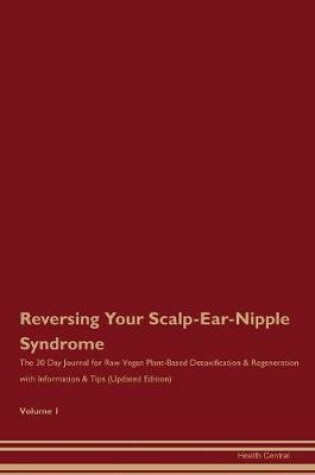 Cover of Reversing Your Scalp-Ear-Nipple Syndrome