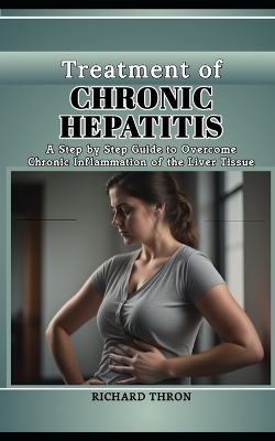 Book cover for Treatment of Chronic Hepatitis