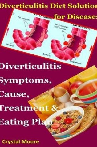 Cover of Diverticulitis Diet Solution for Diseases : Diverticulitis Symptoms, Cause, Treatment & Eating Plan