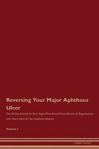 Cover of Reversing Your Major Aphthous Ulcer