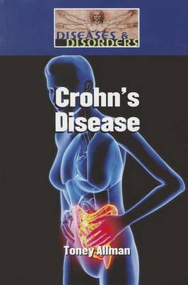 Book cover for Crohn's Disease