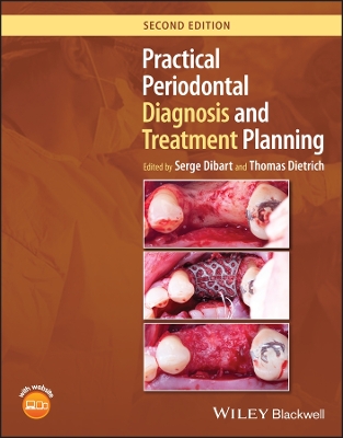 Book cover for Practical Periodontal Diagnosis and Treatment Planning