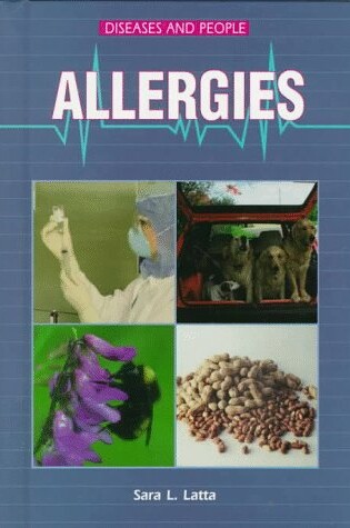 Cover of Allergies