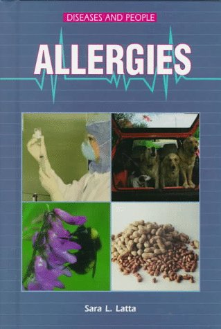 Cover of Allergies