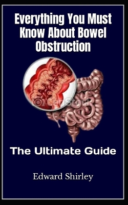 Book cover for Everything You Must Know About Bowel Obstruction