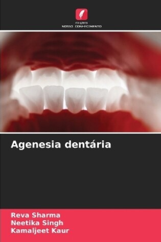 Cover of Agenesia dent�ria