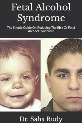 Cover of Fetal Alcohol Syndrome