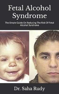 Book cover for Fetal Alcohol Syndrome