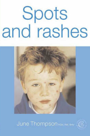 Cover of Spots and Rashes