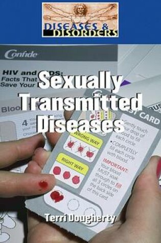 Cover of Sexually Transmitted Diseases