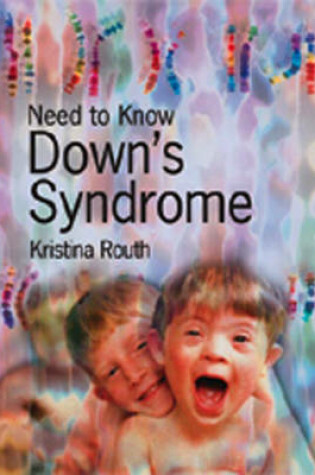 Cover of Need to Know: Downs Syndrome Paperback