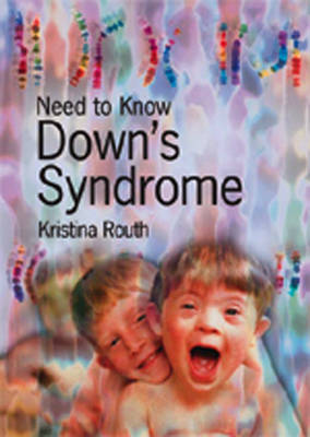 Cover of Need to Know: Downs Syndrome Paperback