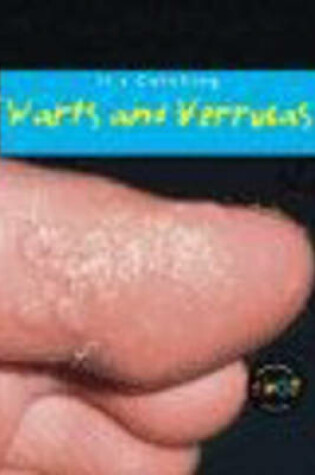 Cover of Warts and Verrucas