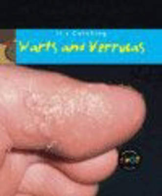 Book cover for It's Catching: Warts and Verrucas