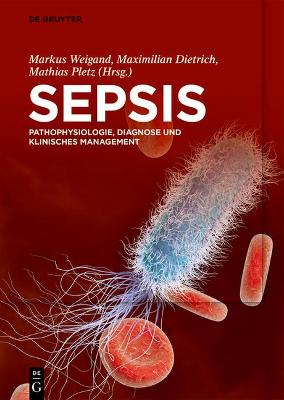 Book cover for Sepsis